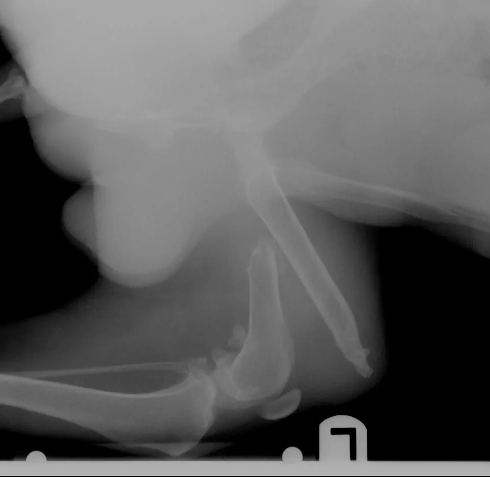 Pierna izquierda de Lu, antes de su operación 